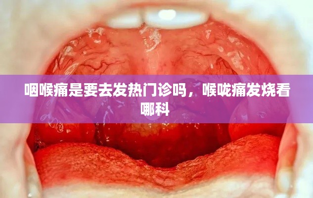 咽喉痛是要去发热门诊吗，喉咙痛发烧看哪科 