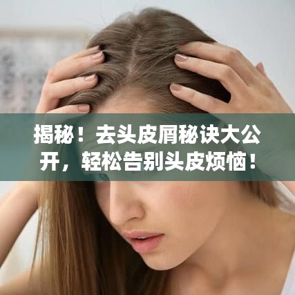 揭秘！去头皮屑秘诀大公开，轻松告别头皮烦恼！百度收录标准吸睛标题