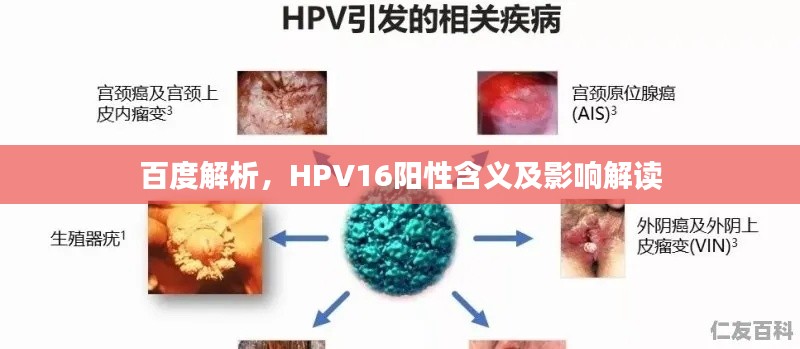 百度解析，HPV16阳性含义及影响解读